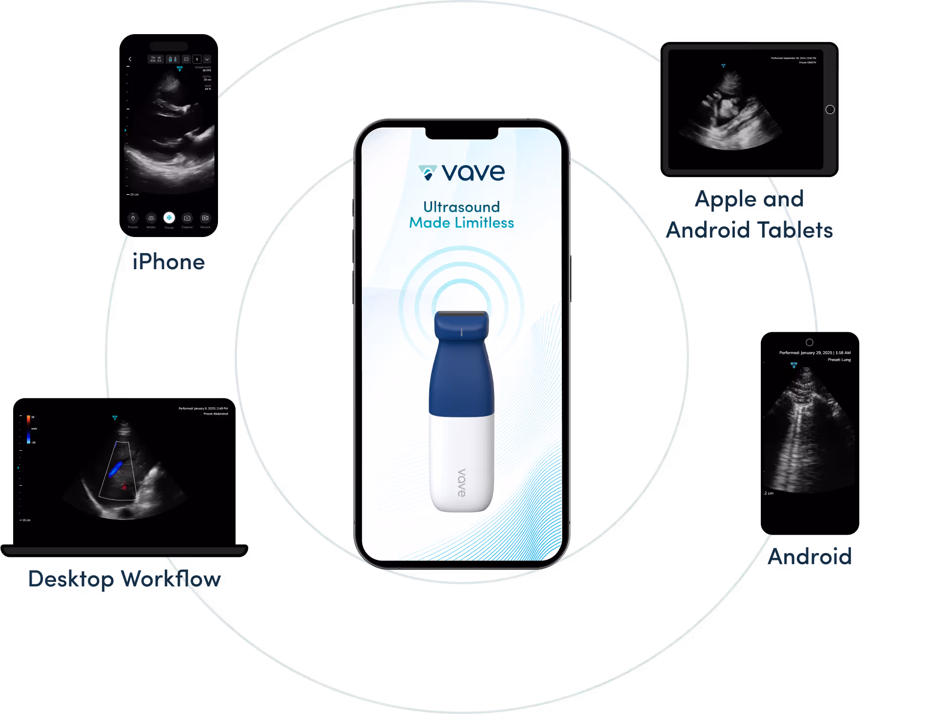 Vave Universal Probe, iPhone, טאבלטים ומחשב