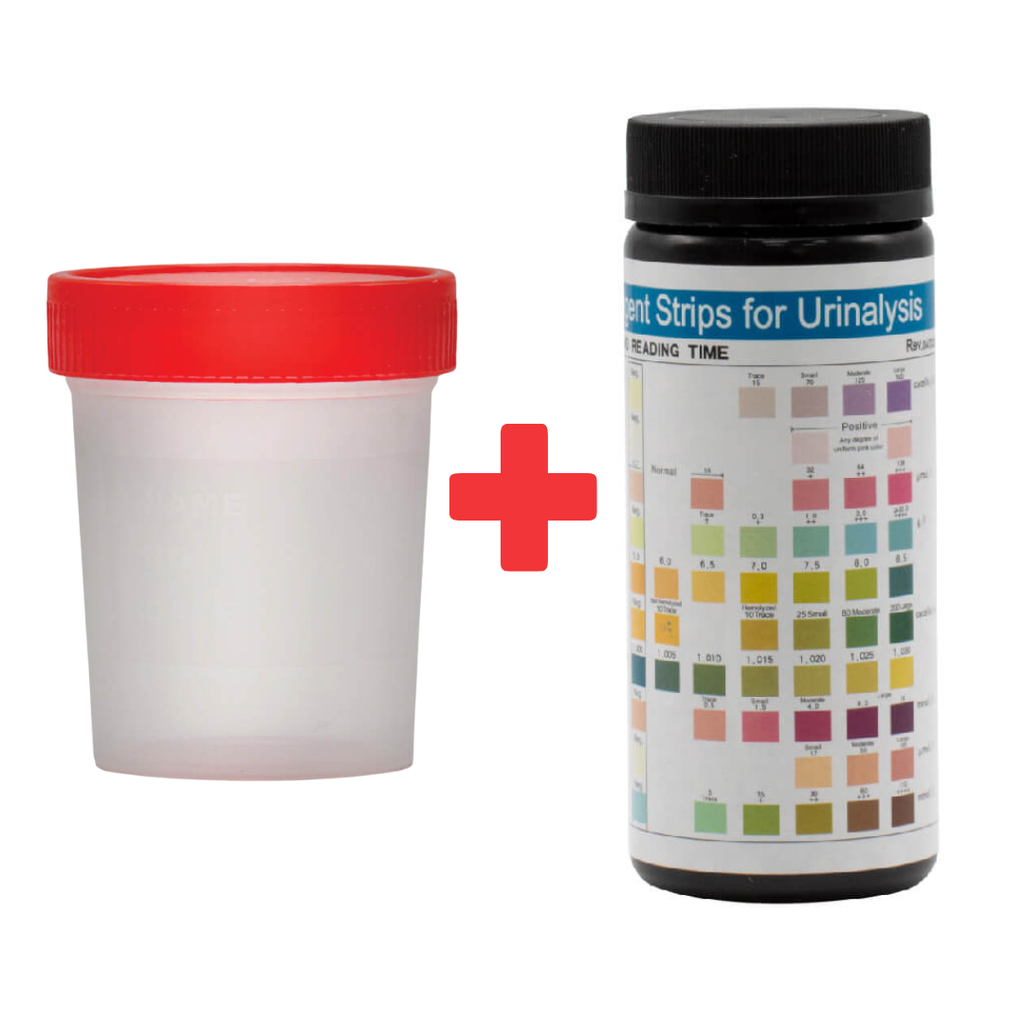 [103011] סטיקים לבדיקת שתן + כוסית שתן. Urine Test Strips + Cup. ערכה ביתית. 100 יחידות. בדיקת 10 פרמטרים: גלוקוז, חלבון, דם, pH, קטונים ועוד. ס.מדיק יבוא